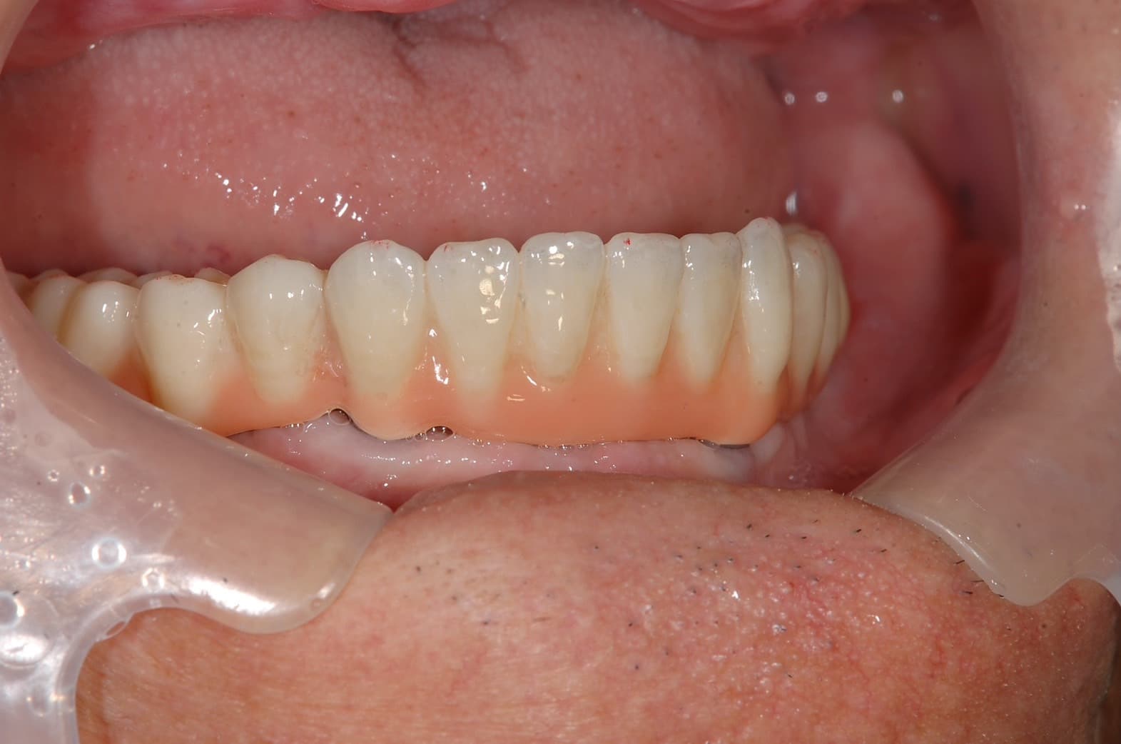 s__10108981_0.jpg